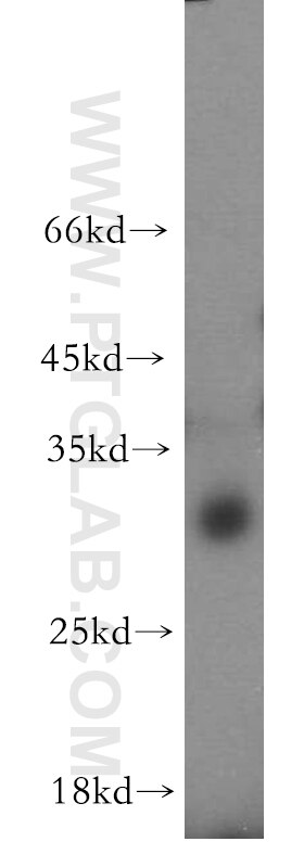 Western Blot (WB) analysis of mouse lung tissue using C11orf49 Polyclonal antibody (20195-1-AP)