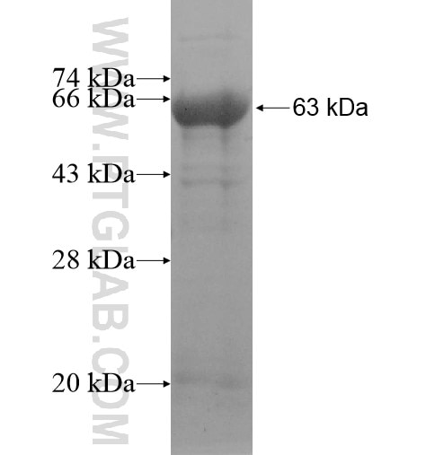 C11orf49 fusion protein Ag14123 SDS-PAGE