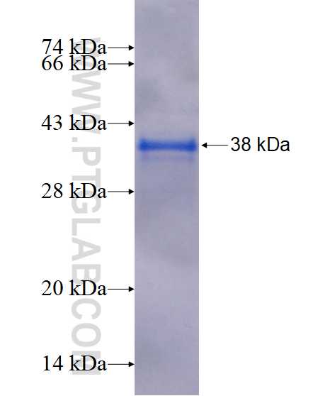 C11orf49 fusion protein Ag16835 SDS-PAGE