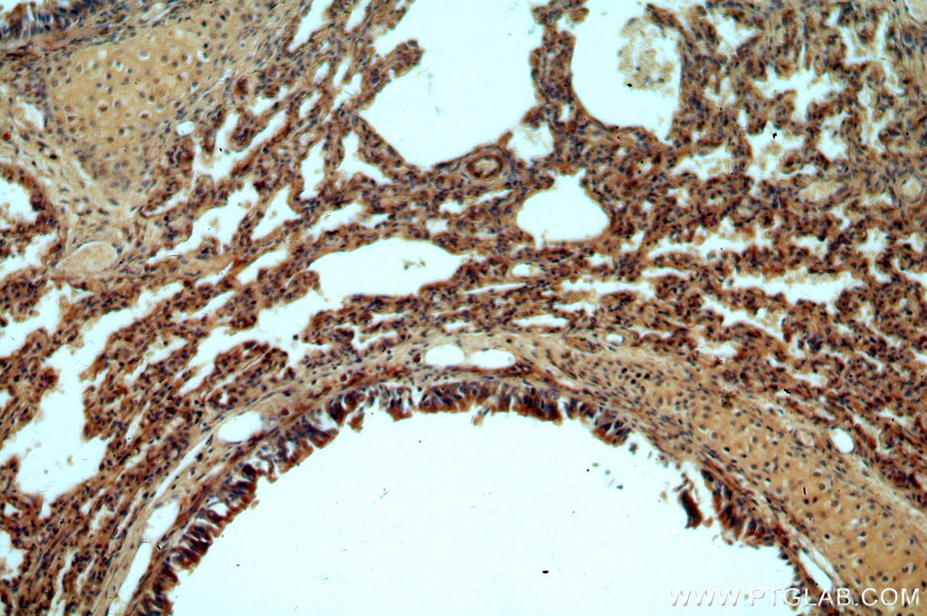 Immunohistochemistry (IHC) staining of human lung tissue using APC15 Polyclonal antibody (20409-1-AP)