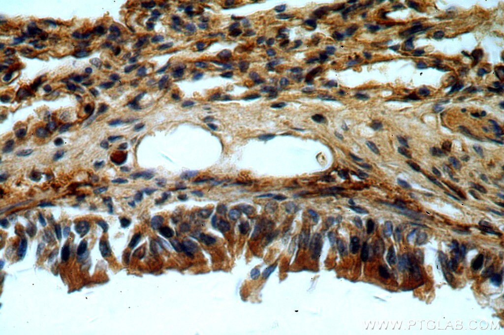 Immunohistochemistry (IHC) staining of human lung tissue using APC15 Polyclonal antibody (20409-1-AP)