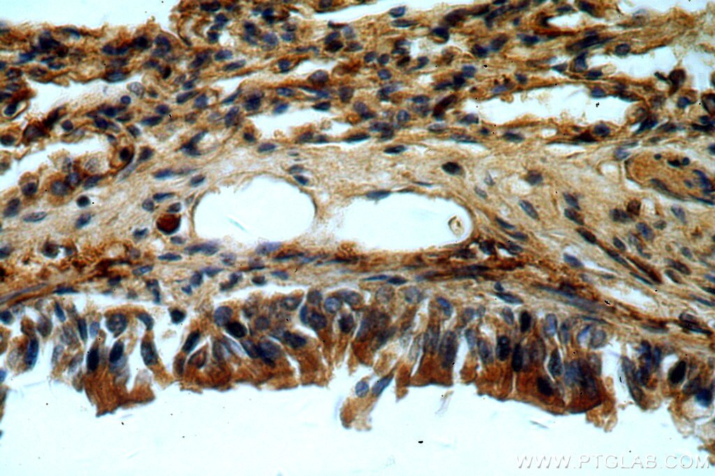 IHC staining of human lung using 20409-1-AP