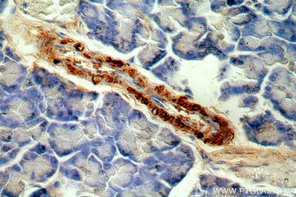 Immunohistochemistry (IHC) staining of human pancreas tissue using APC15 Polyclonal antibody (20409-1-AP)