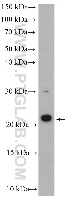 Western Blot (WB) analysis of HEK-293 cells using APC15 Polyclonal antibody (20409-1-AP)