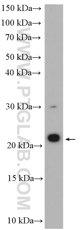 WB analysis of HEK-293 using 20409-1-AP