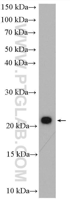 Western Blot (WB) analysis of HT-29 cells using APC15 Polyclonal antibody (20409-1-AP)