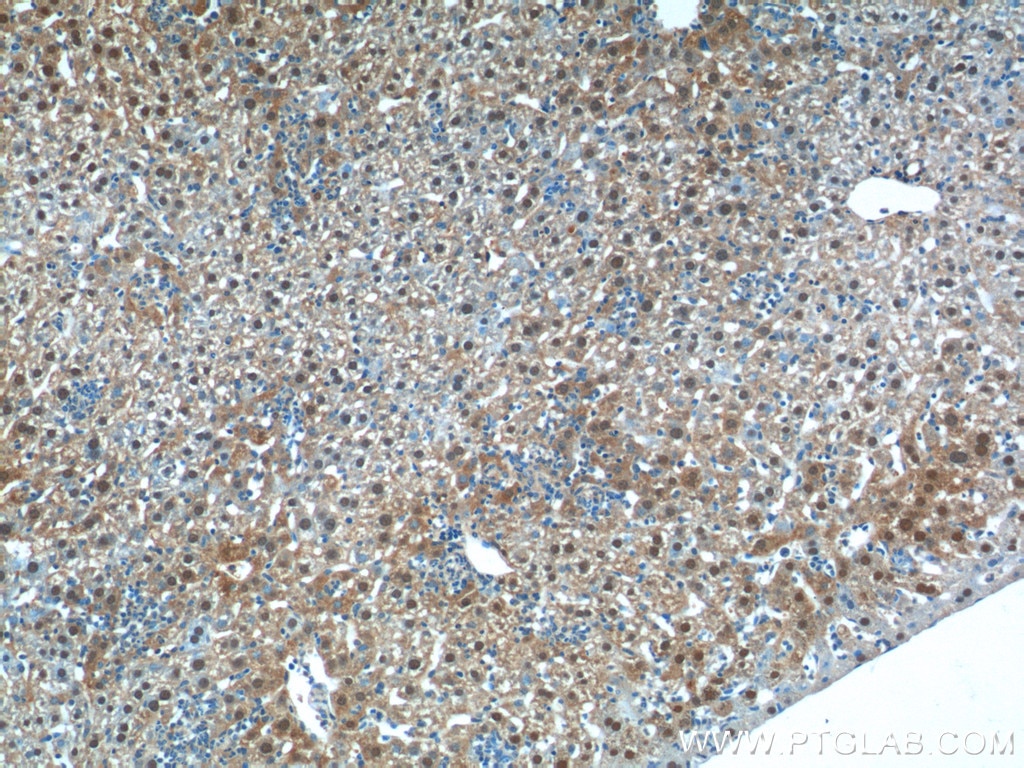Immunohistochemistry (IHC) staining of mouse liver tissue using C11orf54 Polyclonal antibody (23251-1-AP)