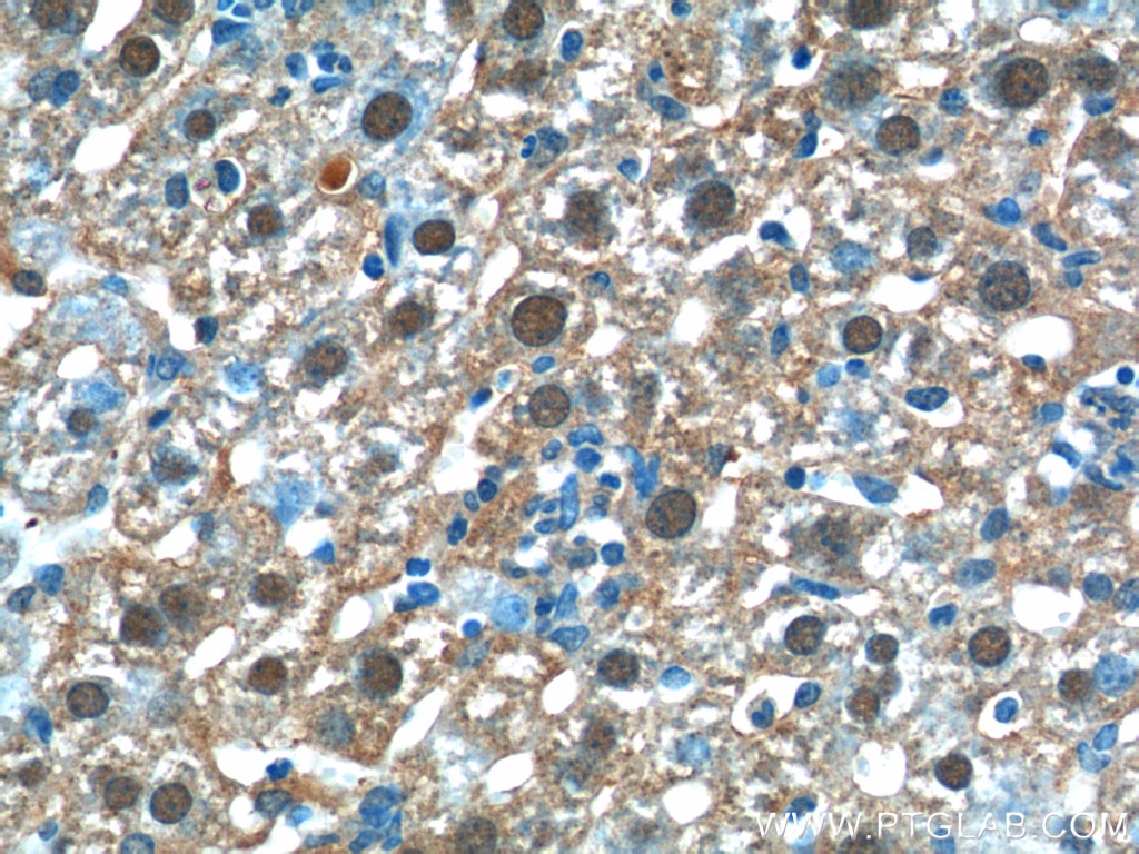 Immunohistochemistry (IHC) staining of mouse liver tissue using C11orf54 Polyclonal antibody (23251-1-AP)