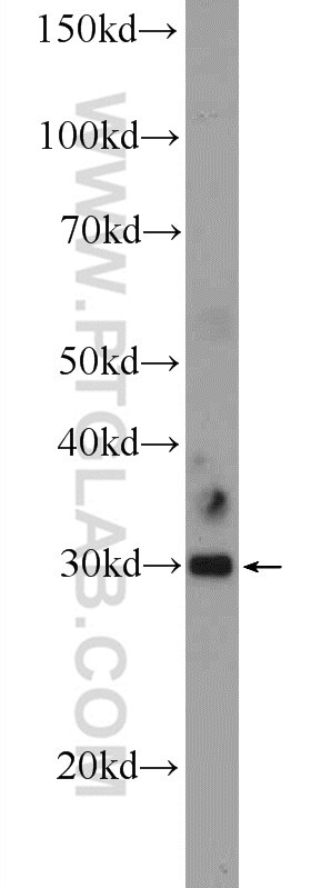 Western Blot (WB) analysis of mouse brain tissue using C11orf57 Polyclonal antibody (21181-1-AP)