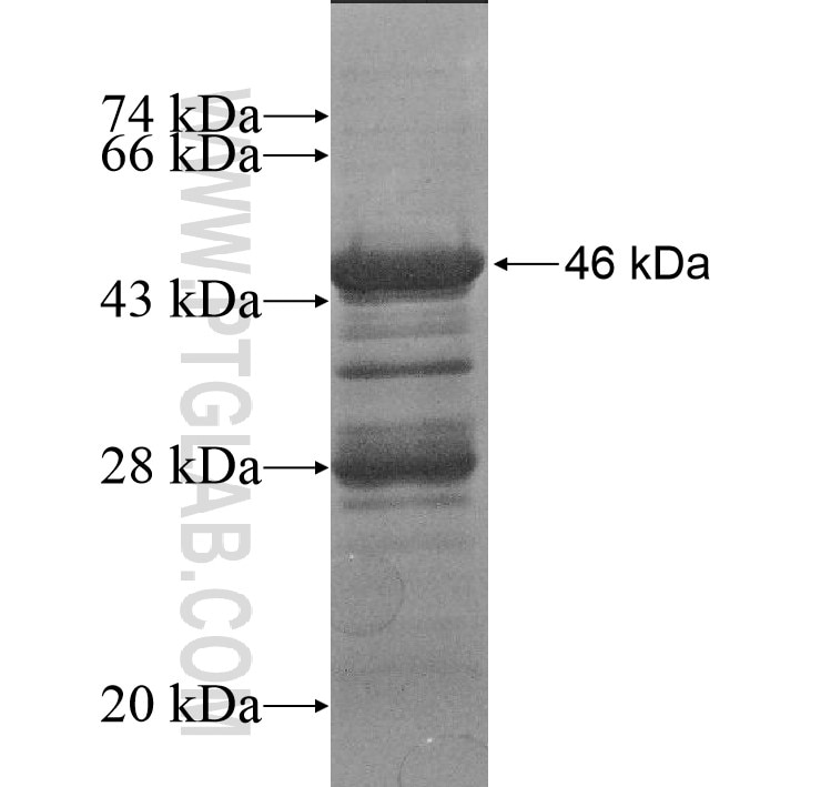 C11orf57 fusion protein Ag15414 SDS-PAGE C11orf57 fusion protein Ag15414 SDS-PAGE