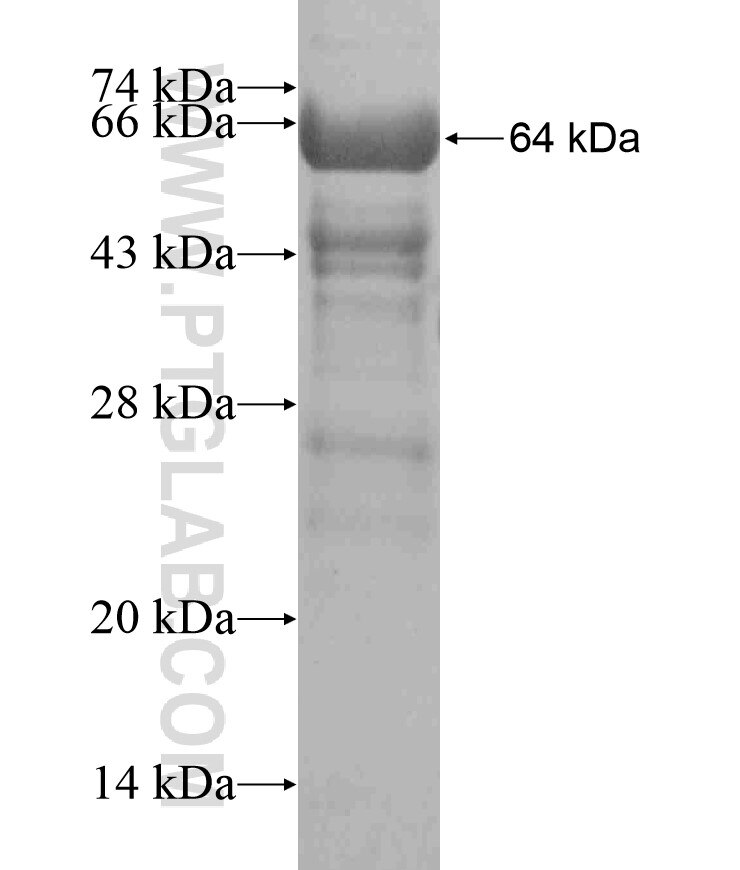 C11orf60 fusion protein Ag18284 SDS-PAGE