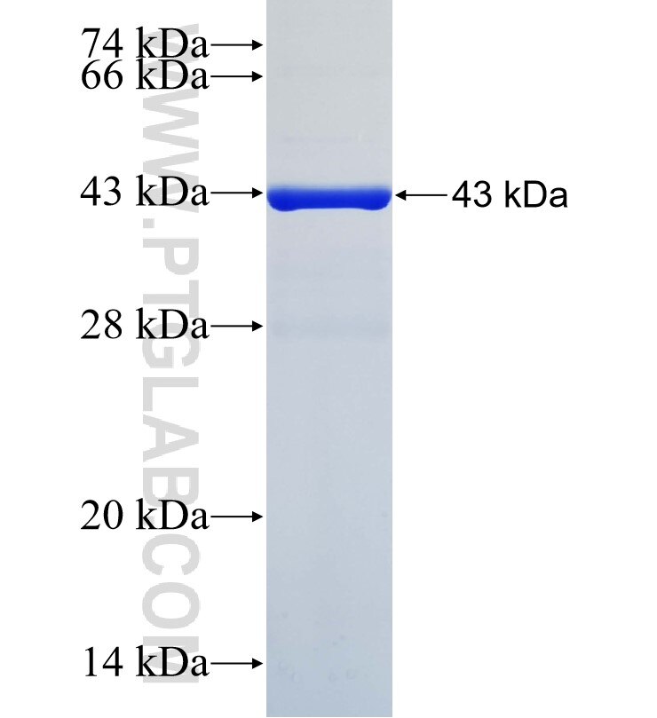 C11orf61 fusion protein Ag36378 SDS-PAGE C11orf61 fusion protein Ag36378 SDS-PAGE