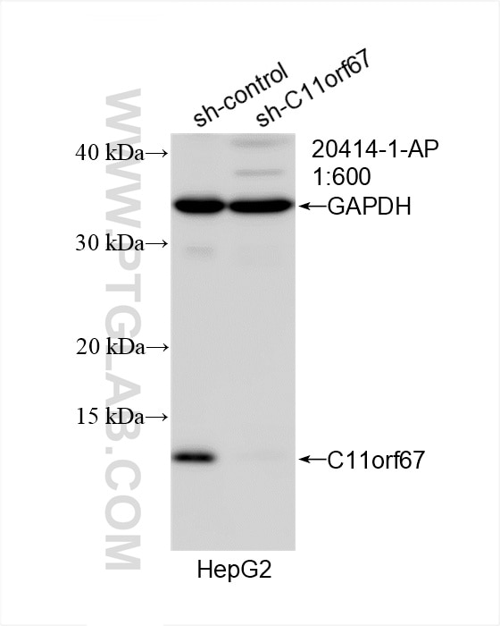 Western Blot (WB) analysis of HepG2 cells using C11orf67 Polyclonal antibody (20414-1-AP)