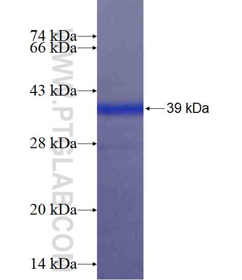 C11orf67 fusion protein Ag14258 SDS-PAGE
