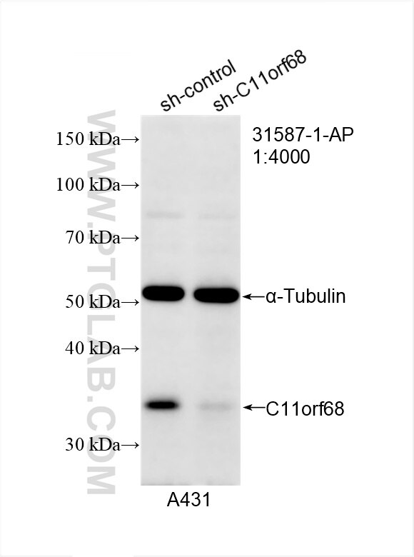 Western Blot (WB) analysis of A431 cells using C11orf68 Polyclonal antibody (31587-1-AP)