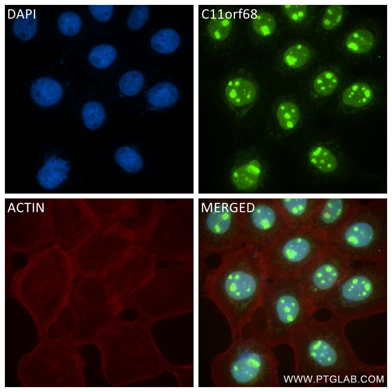 Immunofluorescence (IF) / fluorescent staining of A431 cells using C11orf68 Recombinant antibody (84725-5-RR)