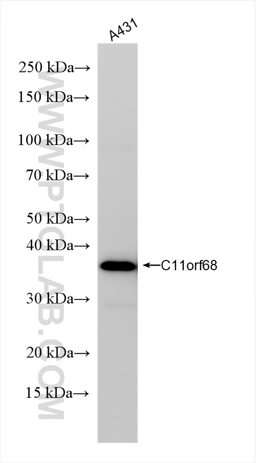 Western Blot (WB) analysis of A431 cells using C11orf68 Recombinant antibody (84725-5-RR)