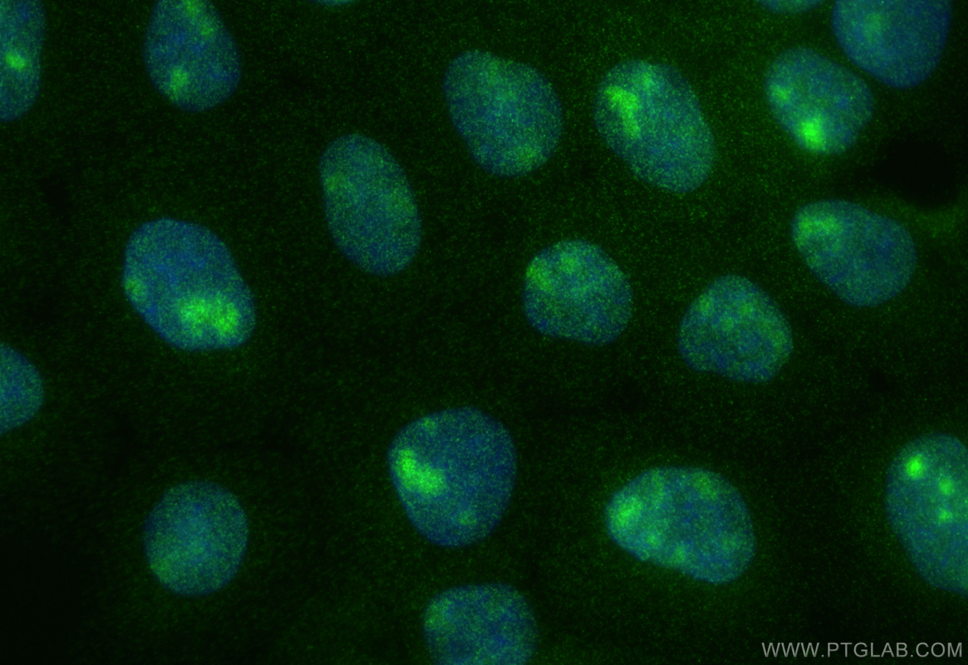 N/A Immunofluorescence (IF) / fluorescent staining of A431 cells using CoraLite® Plus 488-conjugated C11orf68 Recombinant (CL488-84725-5)