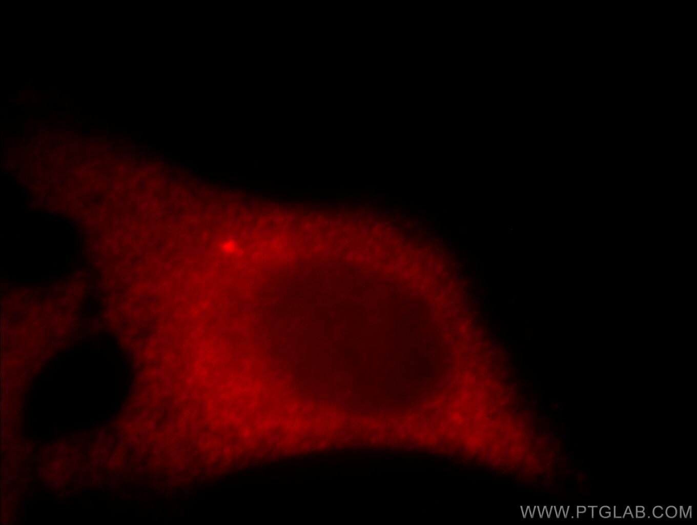 Immunofluorescence (IF) / fluorescent staining of HeLa cells using C11orf70 Polyclonal antibody (20780-1-AP)