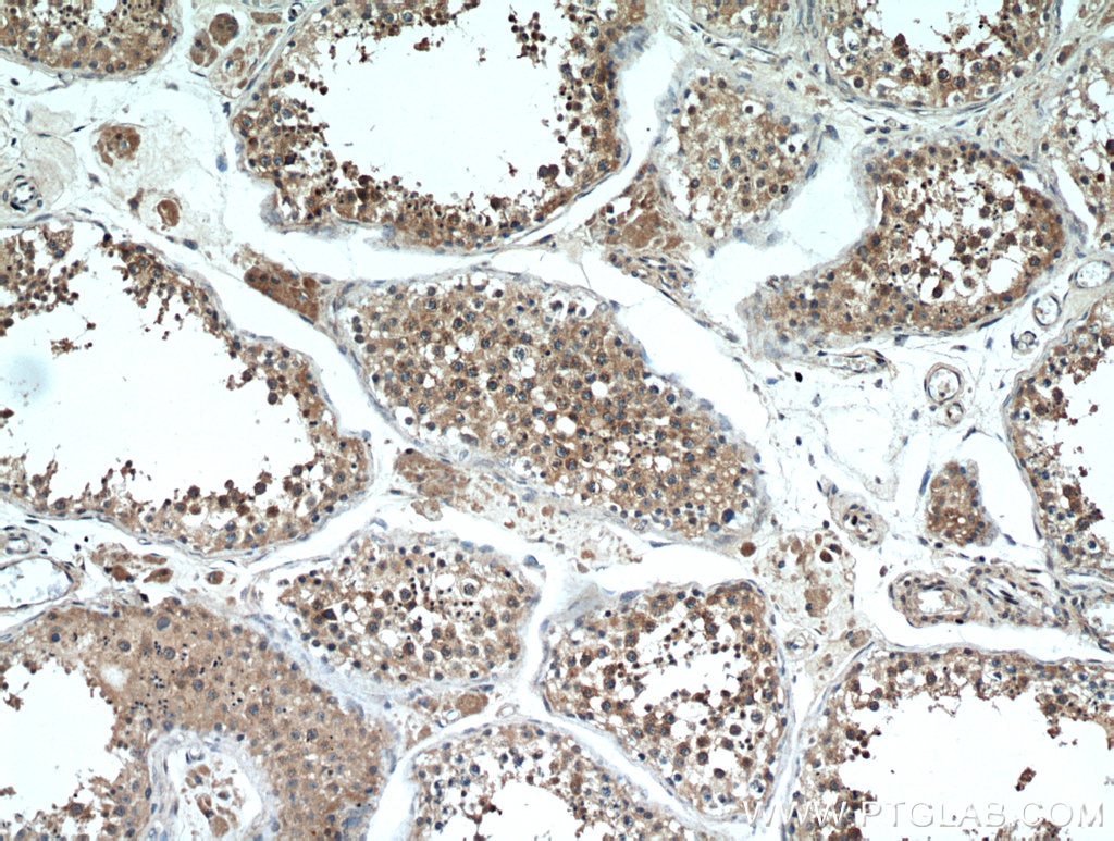 Immunohistochemistry (IHC) staining of human testis tissue using C11orf70 Polyclonal antibody (20780-1-AP)