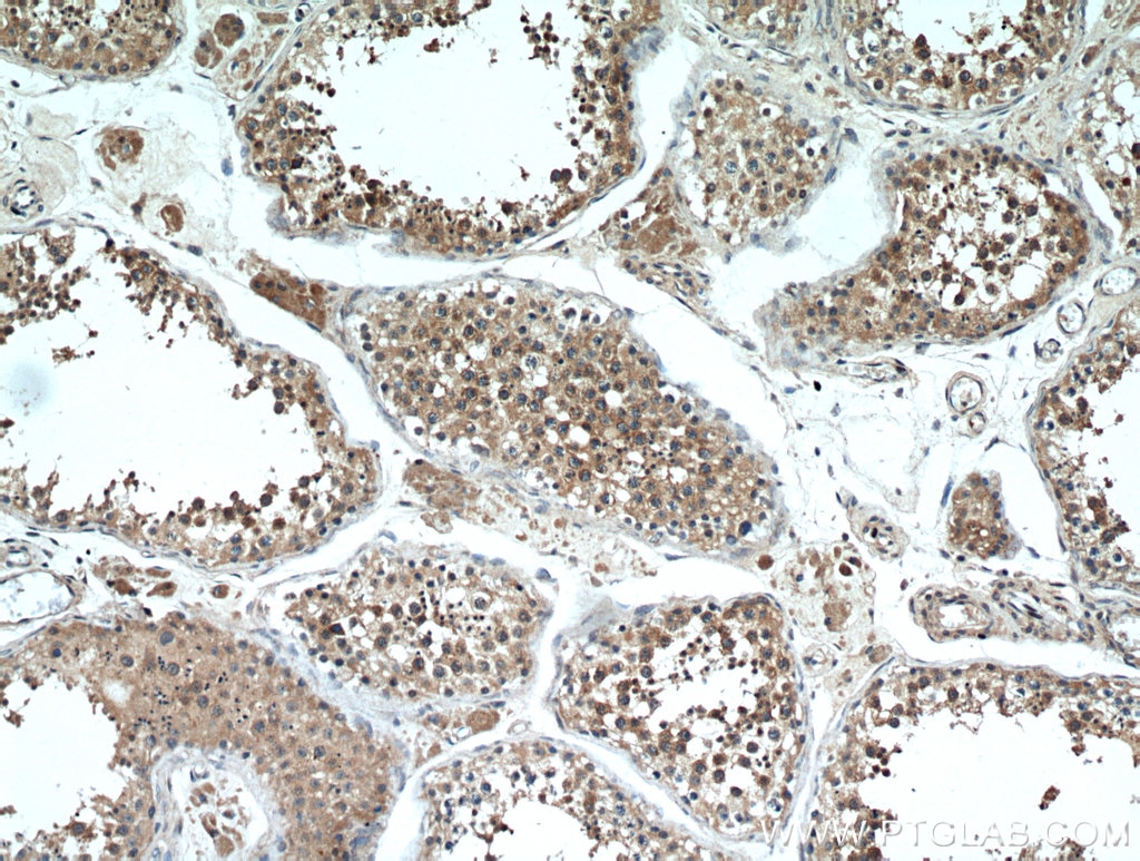 IHC staining of human testis using 20780-1-AP