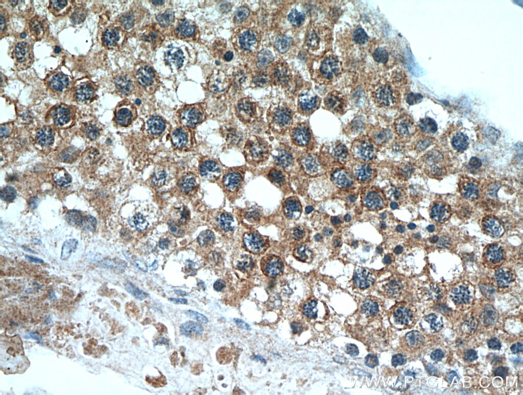 Immunohistochemistry (IHC) staining of human testis tissue using C11orf70 Polyclonal antibody (20780-1-AP)