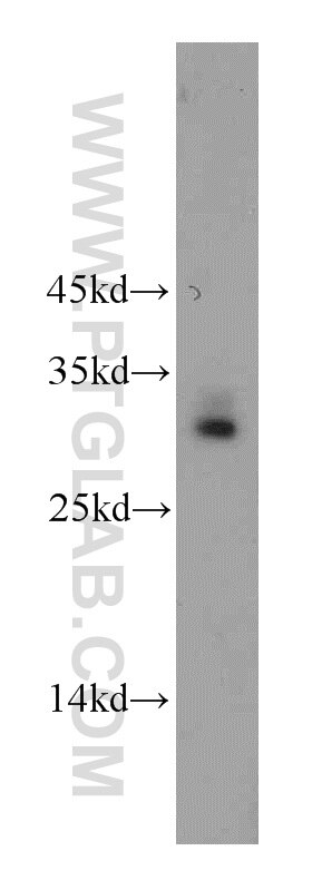 Western Blot (WB) analysis of mouse testis tissue using C11orf70 Polyclonal antibody (20780-1-AP)