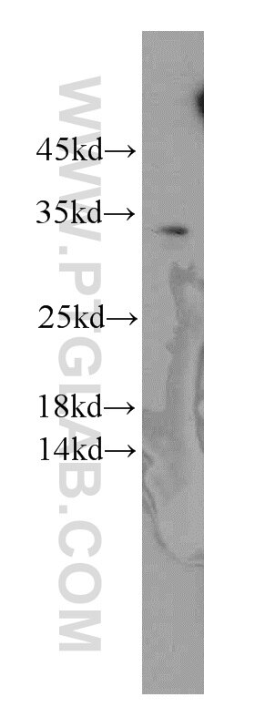 Western Blot (WB) analysis of MCF-7 cells using C11orf70 Polyclonal antibody (20780-1-AP)