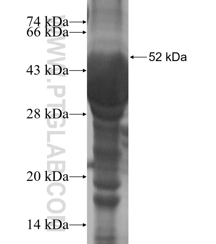 C11orf70 fusion protein Ag14793 SDS-PAGE