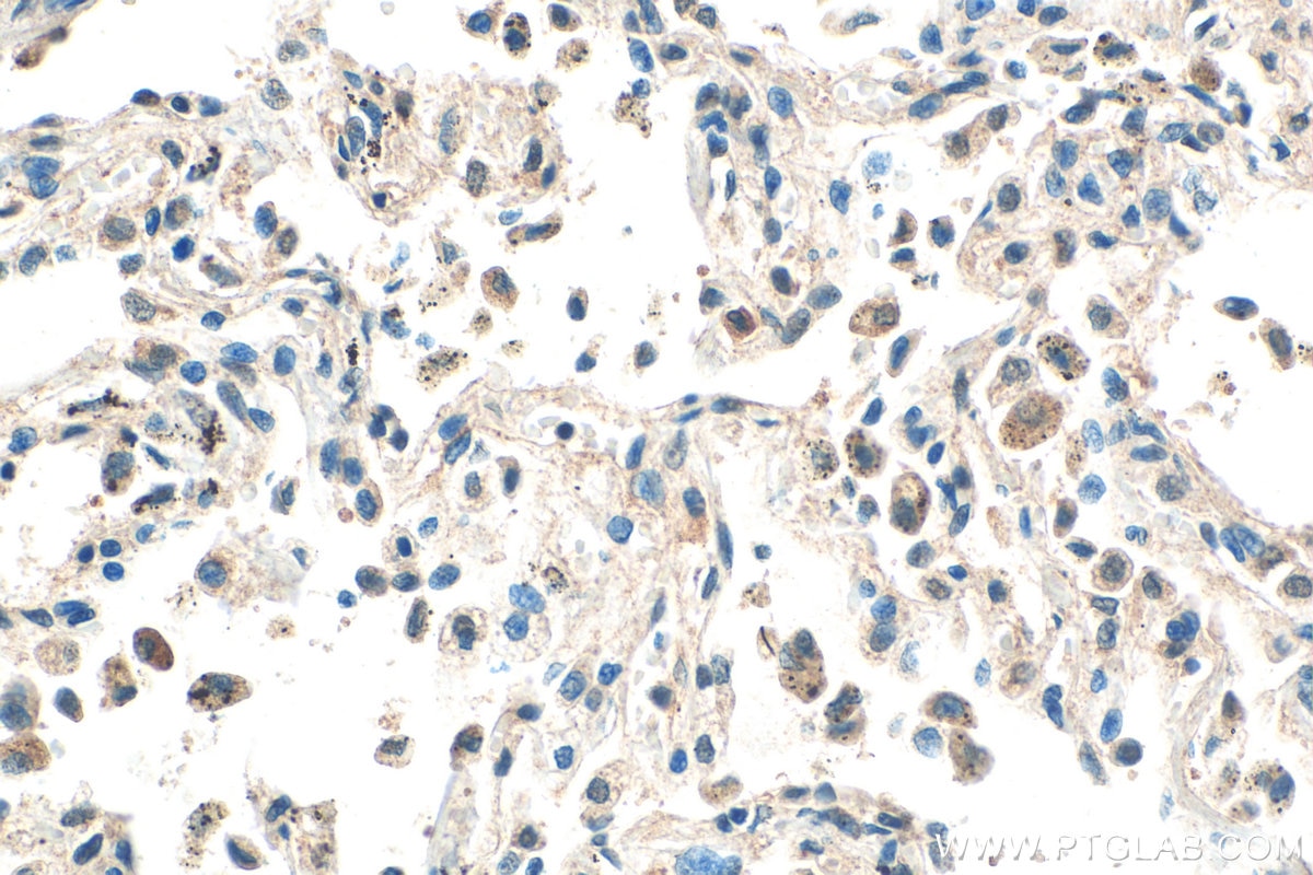 Immunohistochemistry (IHC) staining of human lung tissue using Hikeshi Polyclonal antibody (14808-1-AP)