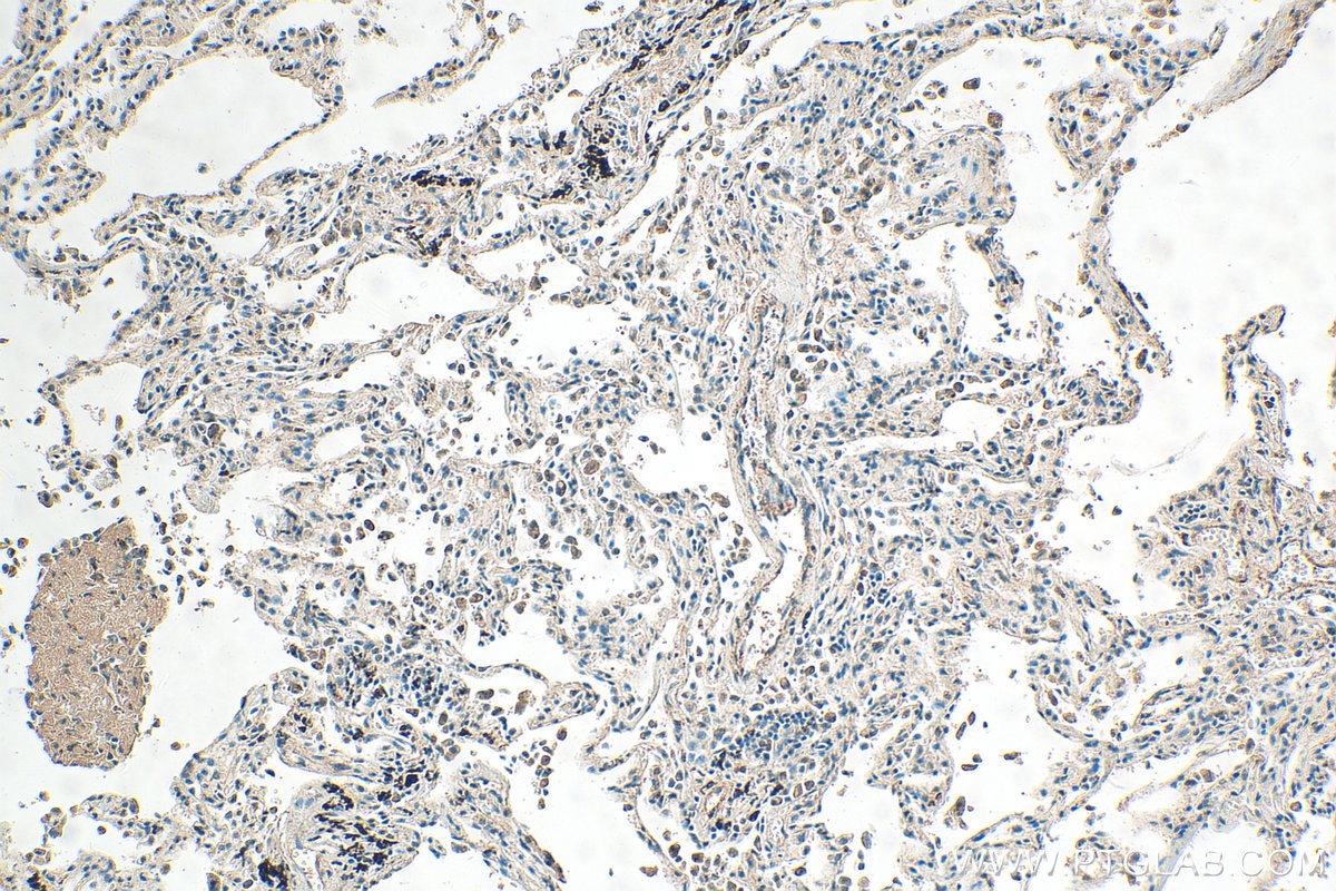 Immunohistochemistry (IHC) staining of human lung tissue using Hikeshi Polyclonal antibody (14808-1-AP)