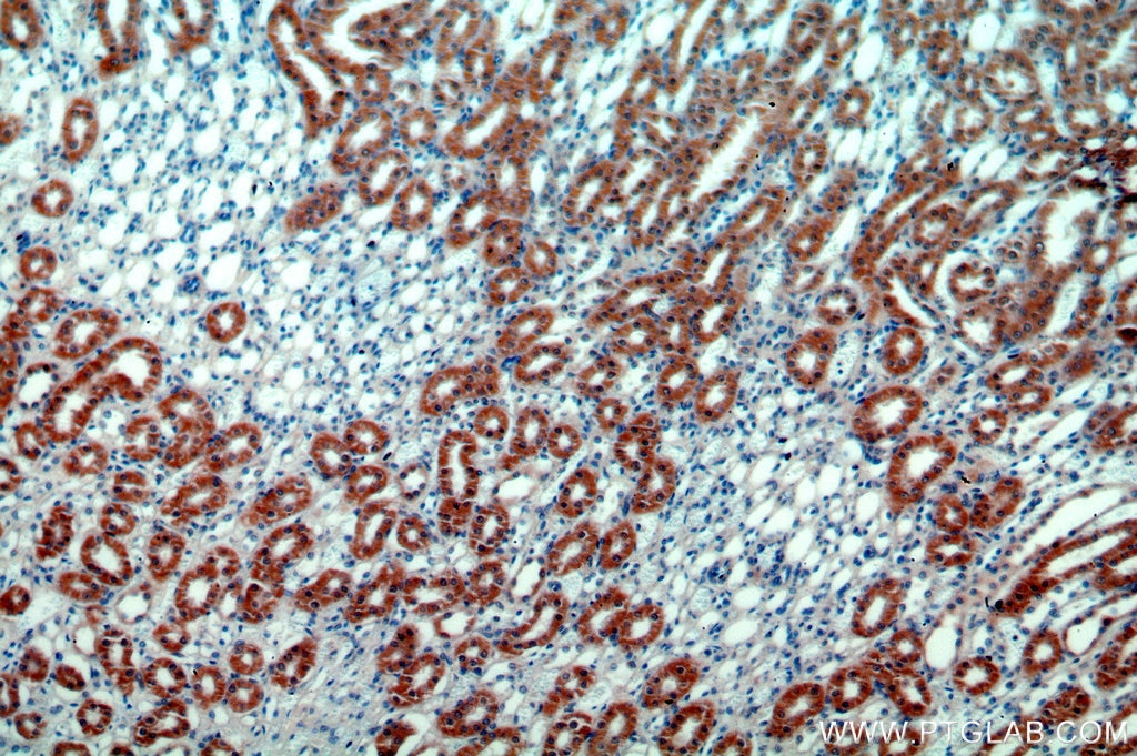 Immunohistochemistry (IHC) staining of human kidney tissue using Hikeshi Polyclonal antibody (14808-1-AP)