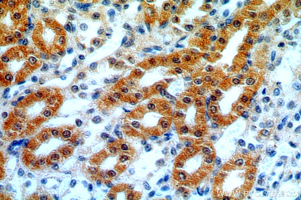 Immunohistochemistry (IHC) staining of human kidney tissue using Hikeshi Polyclonal antibody (14808-1-AP)