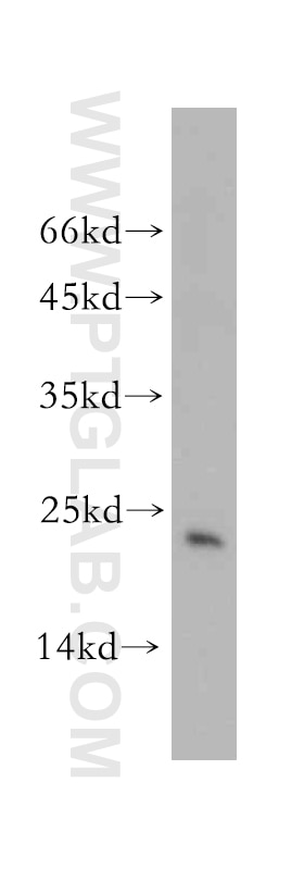 Western Blot (WB) analysis of mouse brain tissue using Hikeshi Polyclonal antibody (14808-1-AP)