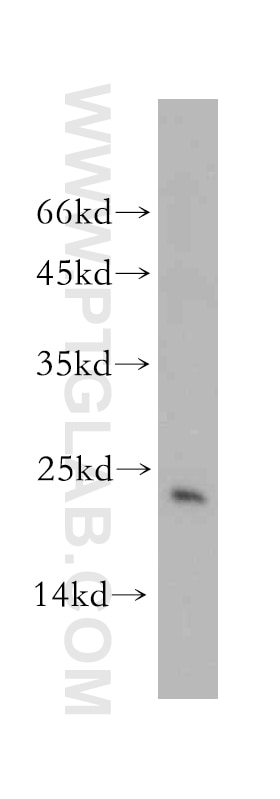 WB analysis of mouse brain using 14808-1-AP