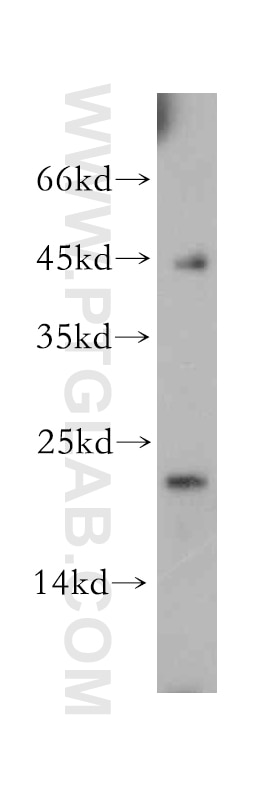 Western Blot (WB) analysis of A375 cells using Hikeshi Polyclonal antibody (14808-1-AP)