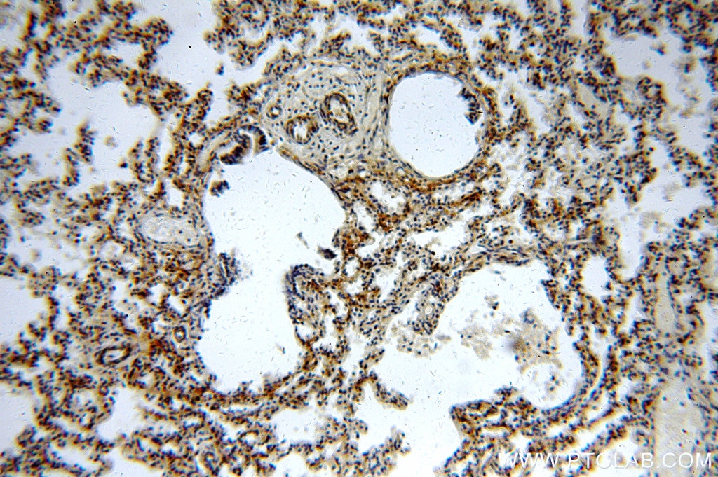 Immunohistochemistry (IHC) staining of human lung tissue using Hikeshi Polyclonal antibody (20524-1-AP)