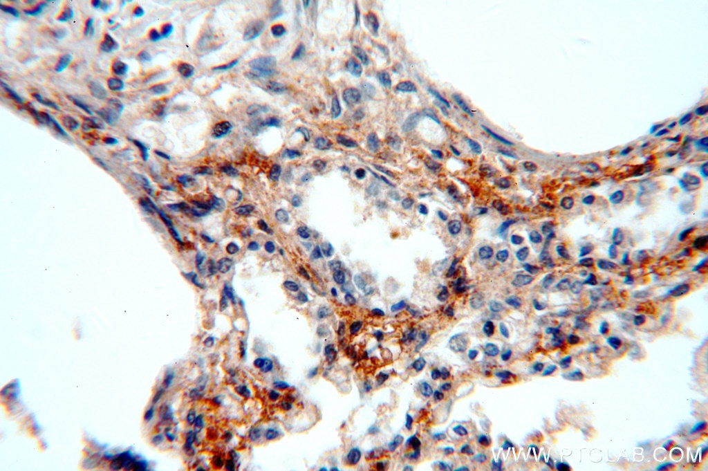 Immunohistochemistry (IHC) staining of human lung tissue using Hikeshi Polyclonal antibody (20524-1-AP)