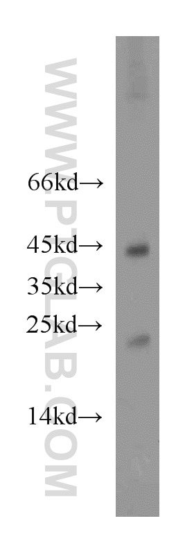 Western Blot (WB) analysis of A375 cells using Hikeshi Polyclonal antibody (20524-1-AP)