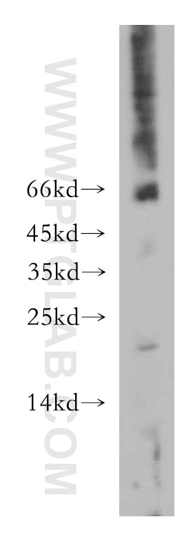 Western Blot (WB) analysis of mouse brain tissue using Hikeshi Polyclonal antibody (20524-1-AP)