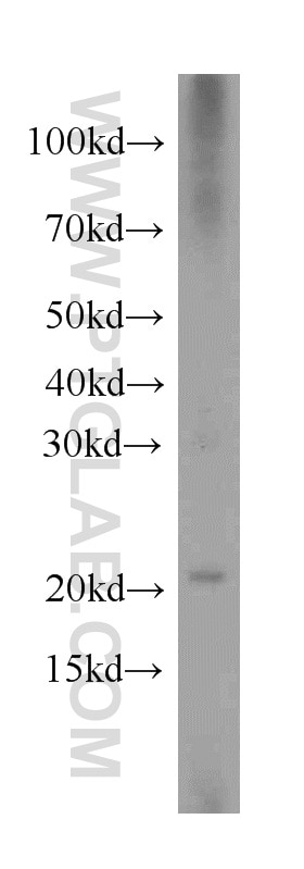 Western Blot (WB) analysis of PC-3 cells using Hikeshi Polyclonal antibody (20524-1-AP)