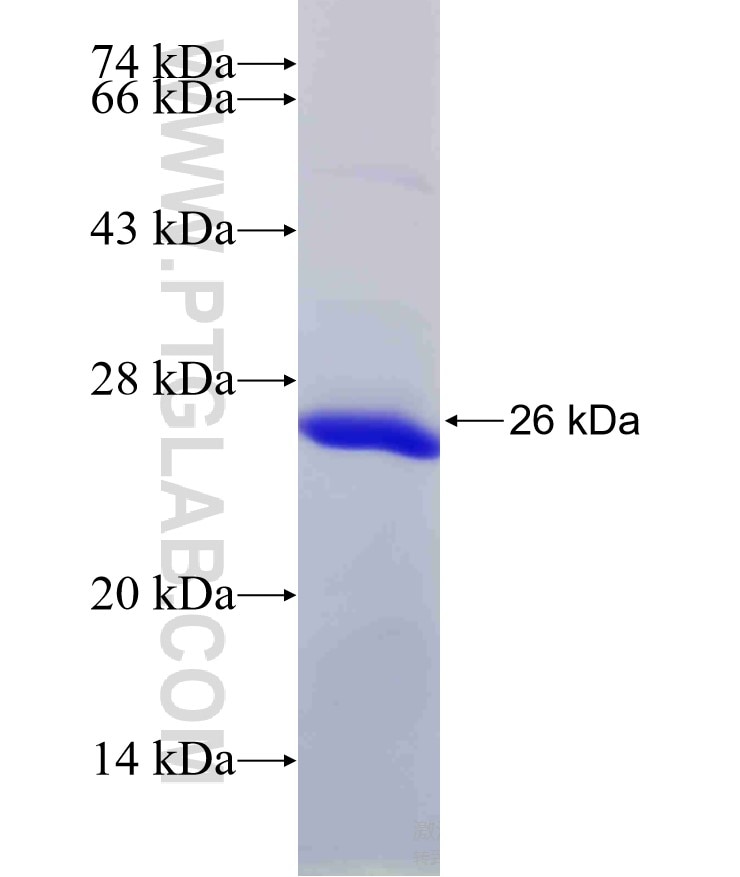 C11orf73 fusion protein Ag14376 SDS-PAGE