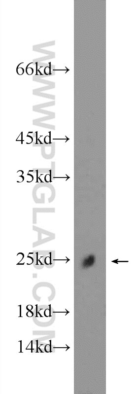 Western Blot (WB) analysis of mouse skeletal muscle tissue using C11orf74 Polyclonal antibody (25758-1-AP)