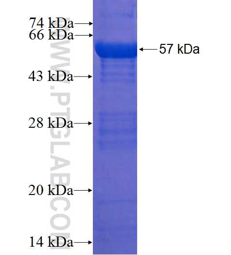 C11orf74 fusion protein Ag22770 SDS-PAGE