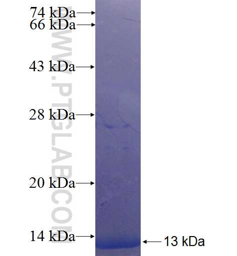 C11orf75 fusion protein Ag22806 SDS-PAGE