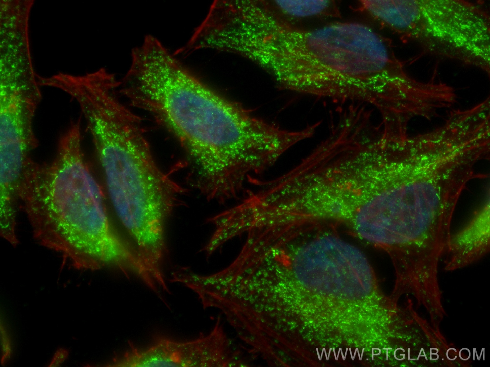 Immunofluorescence (IF) / fluorescent staining of HeLa cells using SDH5 Polyclonal antibody (19906-1-AP)