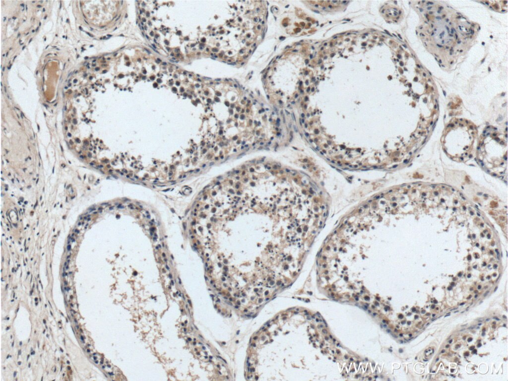 Immunohistochemistry (IHC) staining of human testis tissue using SDH5 Polyclonal antibody (19906-1-AP)