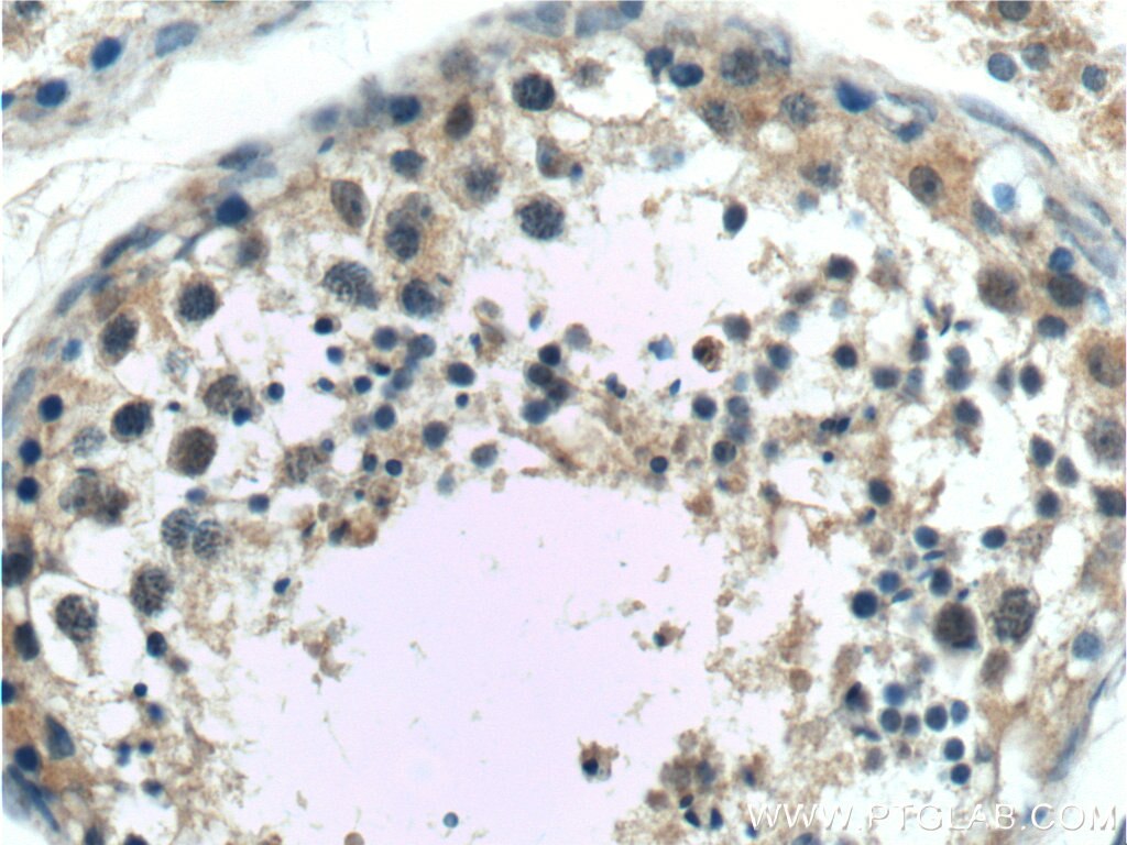 Immunohistochemistry (IHC) staining of human testis tissue using SDH5 Polyclonal antibody (19906-1-AP)