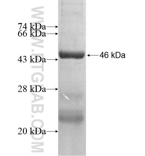 C11orf79 fusion protein Ag13893 SDS-PAGE