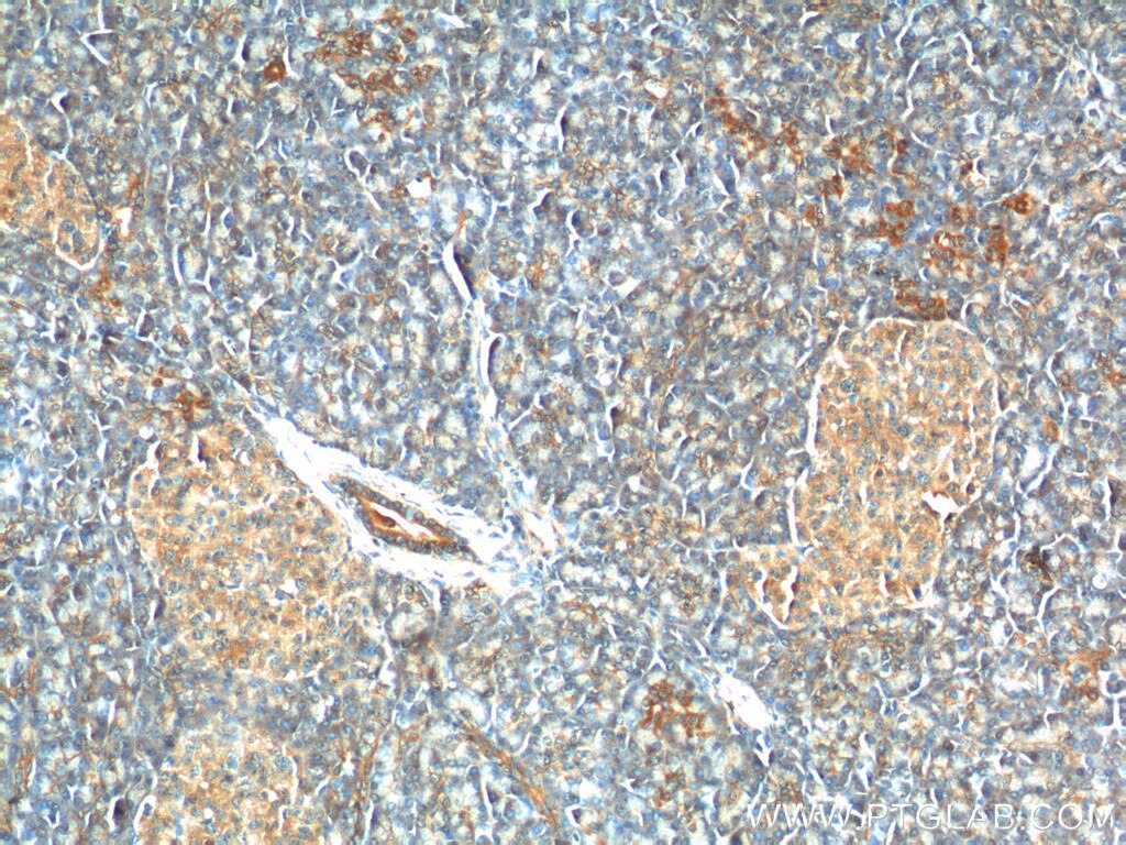 Immunohistochemistry (IHC) staining of human pancreas tissue using C11orf80 Polyclonal antibody (25957-1-AP)